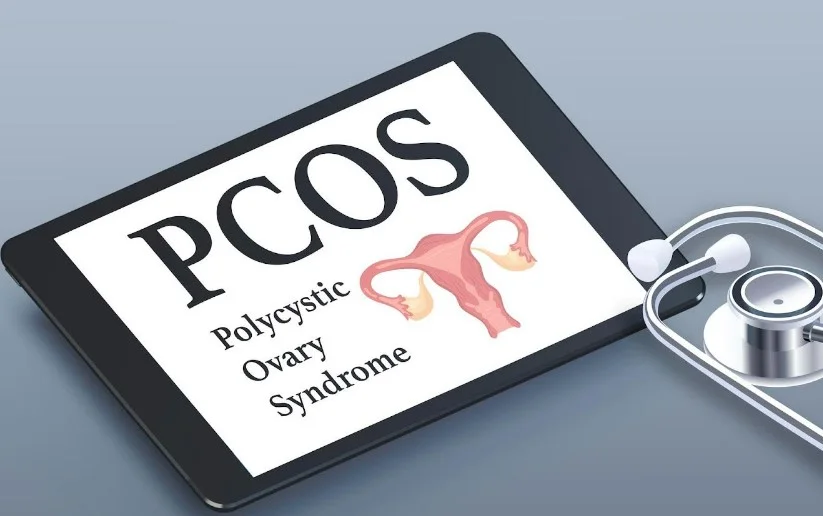PCOS чи PMOS? Синдром полікістозних яєчників отримав нову назву завдяки зміні уявлень про хворобу