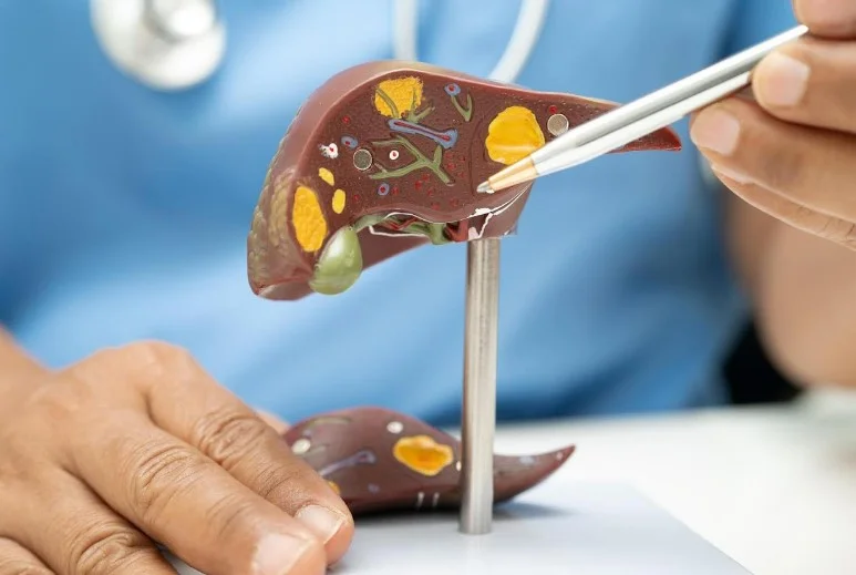 Спадкова гіпербілірубінемія: особливості діагностики та лікування відповідно до останніх клінічних рекомендацій